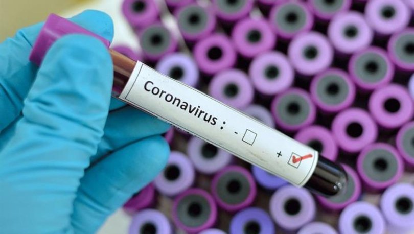 koronavirüs testi nasıl yapılıyor